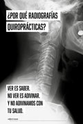 Why Chiropractic X-Rays? Spanish