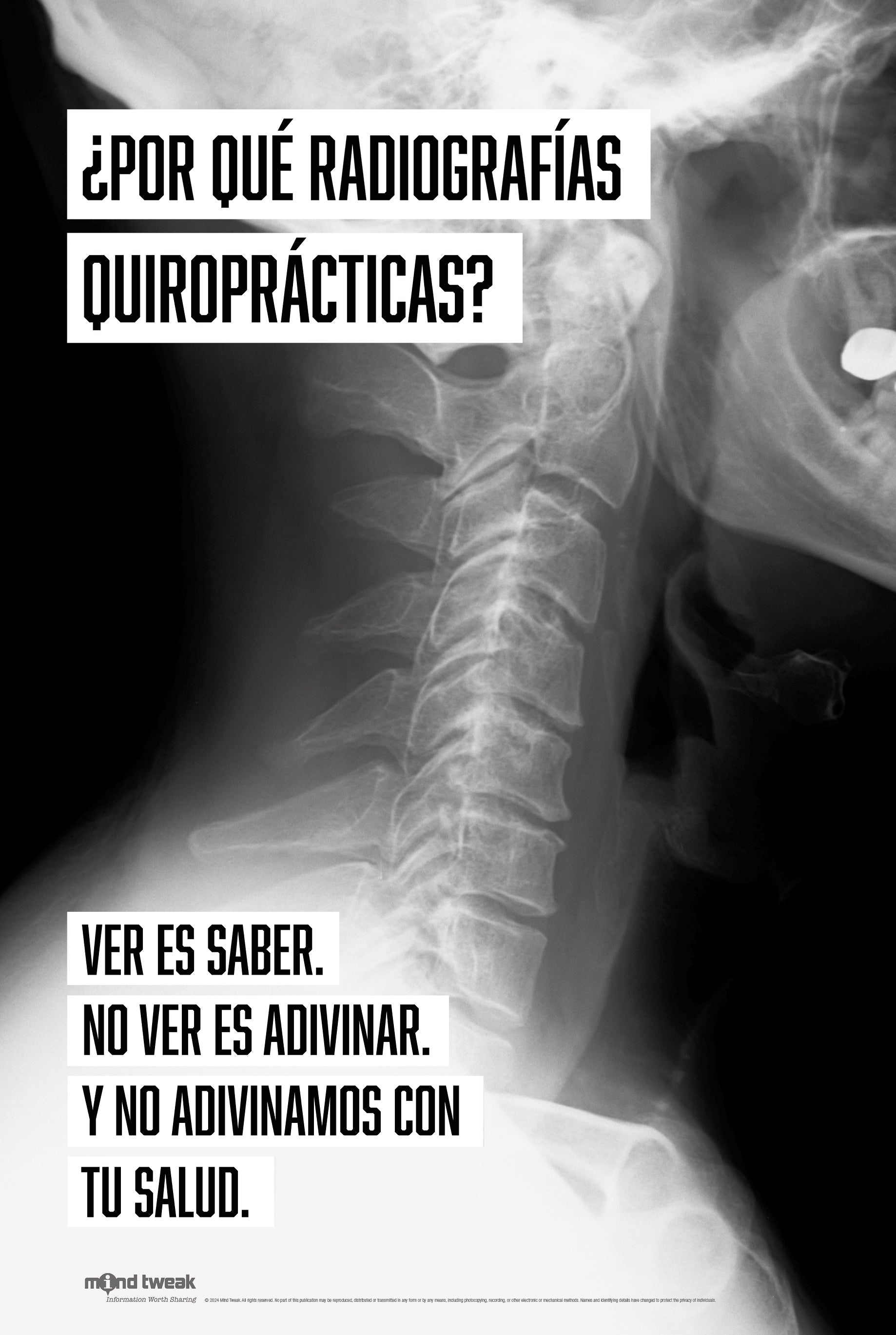 Why Chiropractic X-Rays? Spanish