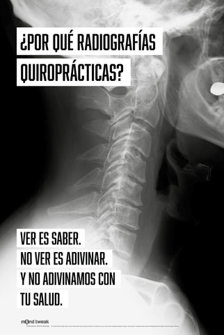 Why Chiropractic X-Rays? Spanish