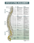 Effects of Spinal MISALIGNMENTS