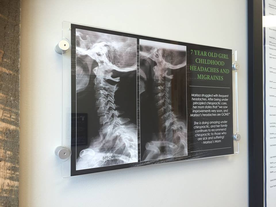 X-Ray Success Poster Series