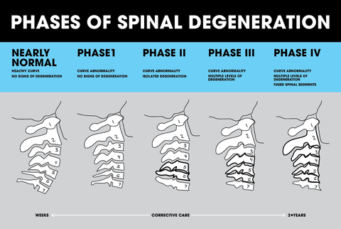 Phases of Spinal Degeneration