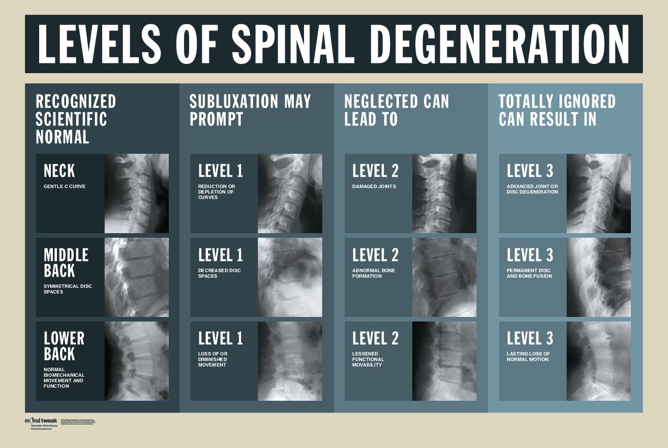 Levels of Spinal Degeneration