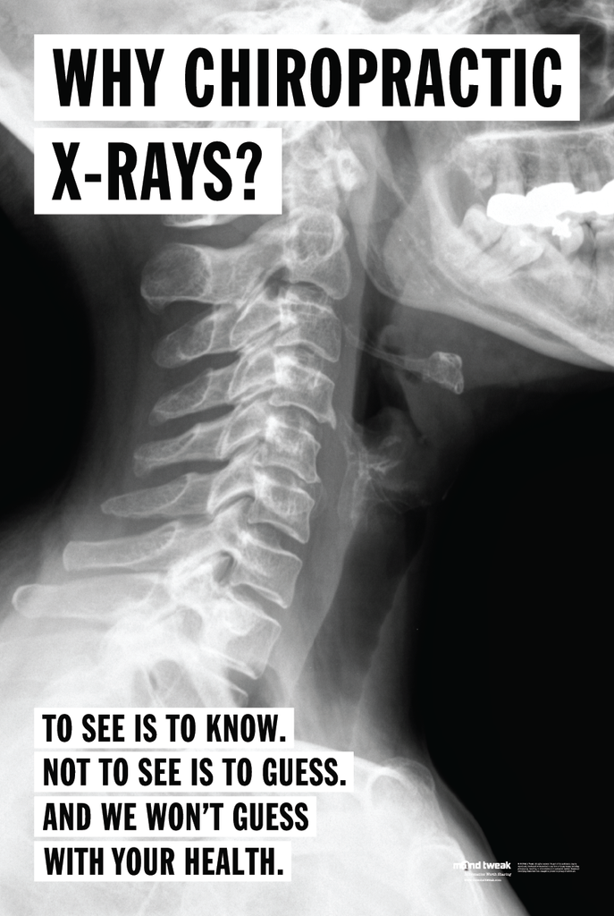 Why Chiropractic X-Rays?
